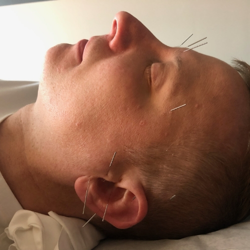 accupuncture-Jennifer-Scherbauer-DC-ND-LLC-chicago-il