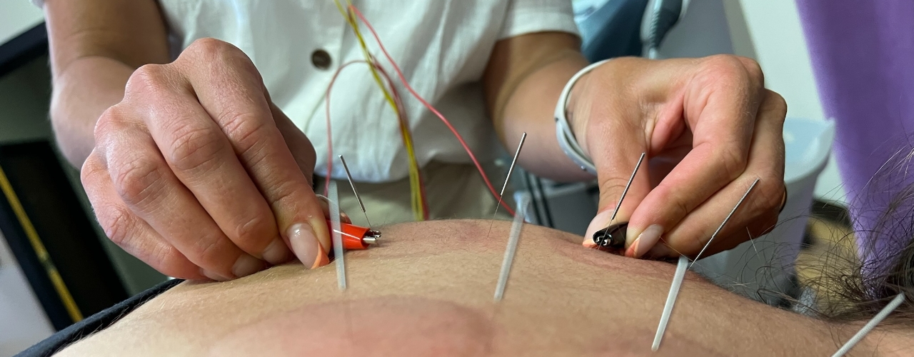 acupuncture-Jennifer-DC-ND-LLC-cihiropractor-chicago-il