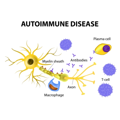 autoimmune-2-Jennifer-Scherbauer-DC-ND-LLC-chicago-il