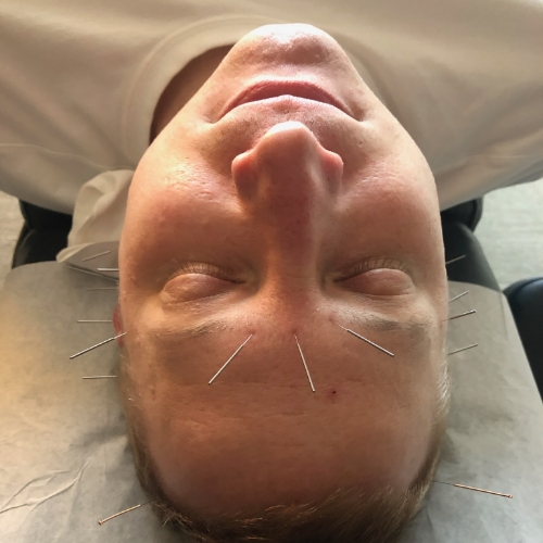 headaches-2-Jennifer-Scherbauer-DC-ND-LLC-chicago-il