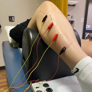 sports-injury-Jennifer-Scherbauer-DC-ND-LLC-chicago-il