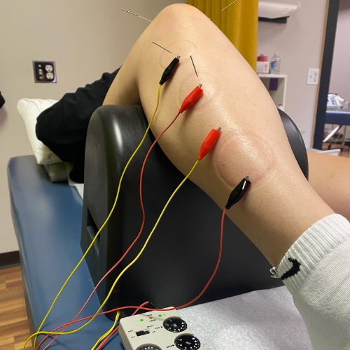 sports-injury-Jennifer-Scherbauer-DC-ND-LLC-chicago-il