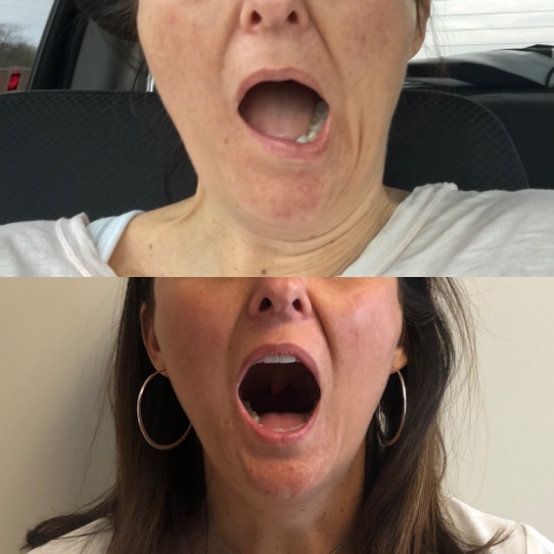 tmj-2-Jennifer-Scherbauer-DC-ND-LLC-chicago-il