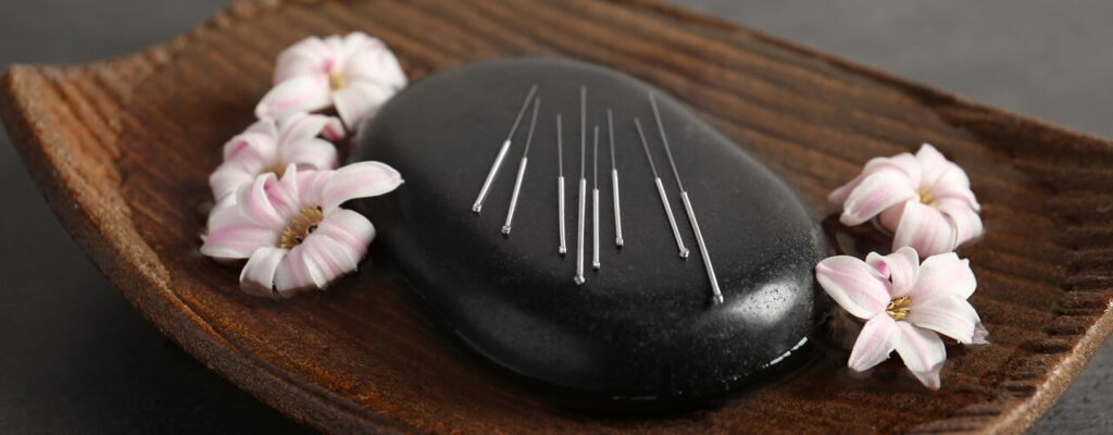 Balancing Hormones with Acupuncture: Women’s Wellness