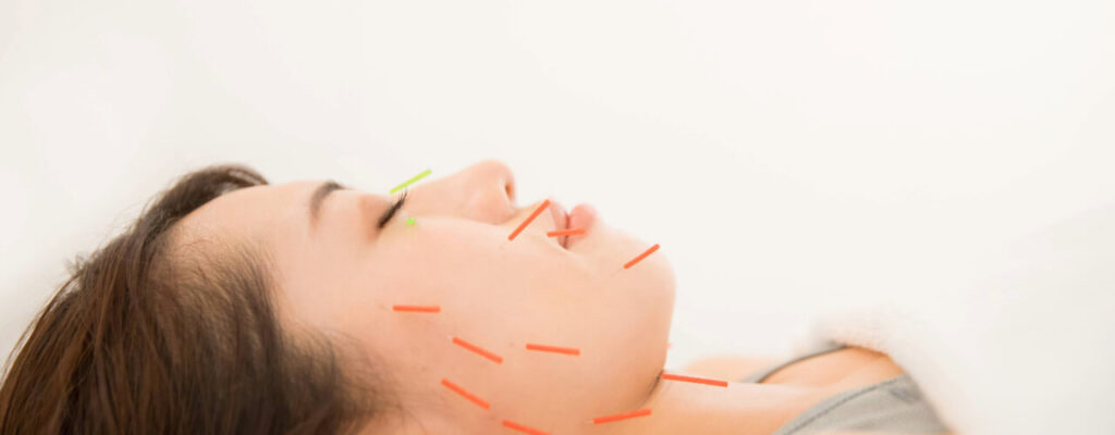 Debunking Common Acupuncture Myths and Misconceptions